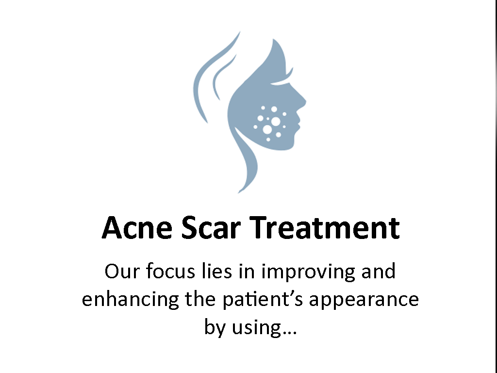 Top Acne Scar Treatment service in new delhi.